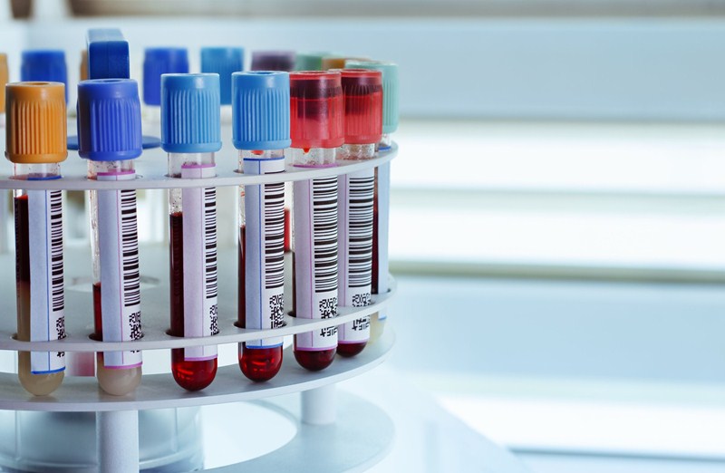 Guidance for employers and businesses on the coronavirus